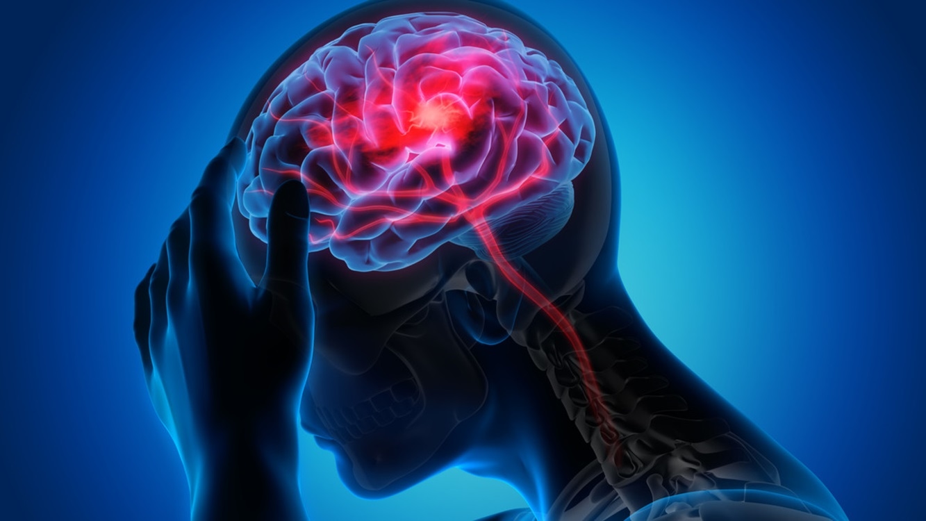 Panduan Pola Makan Pasca-Stroke: Ini Makanan yang Membantu Pemulihan Lebih Cepat