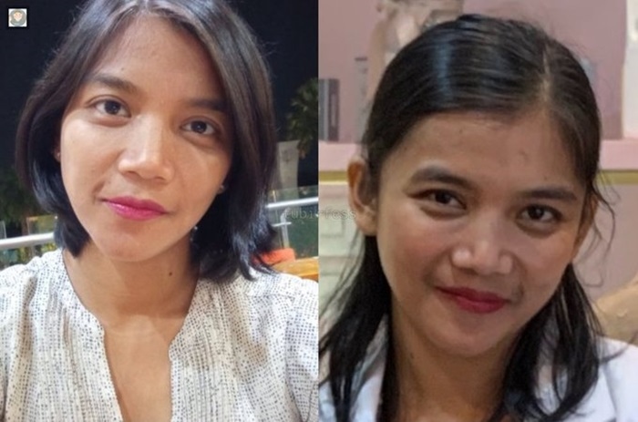 Dokter Qory Lulusan Mana, Simak Profil Lengkap Akun Instagram, X Twitter Beserta Klinik Dan Rumah Sakit Tempat Praktiknya