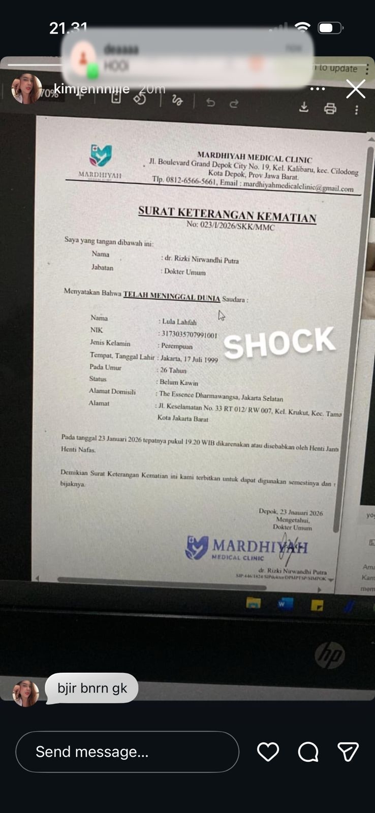 Kabar Duka, Selebgram Lula Lahfah Meninggal Dunia, Alami Henti Jantung