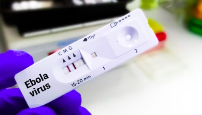 Apa Itu Virus Ebola? Kenali Gejala dan Cara Penularannya