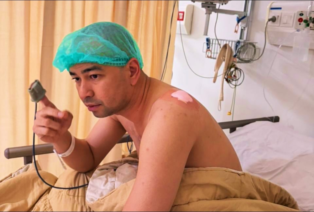 Bukan Baru Tahu, Aldi Taher Ternyata Sudah Bocorkan Kondisi Benjolan di Punggung Raffi Ahmad Sejak Sebelum Haji