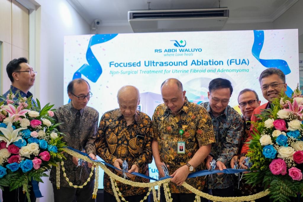 Lakukan Transformasi, RS Abdi Waluyo Hadirkan Focused Ultrasound Ablation Untuk Pasien Mioma