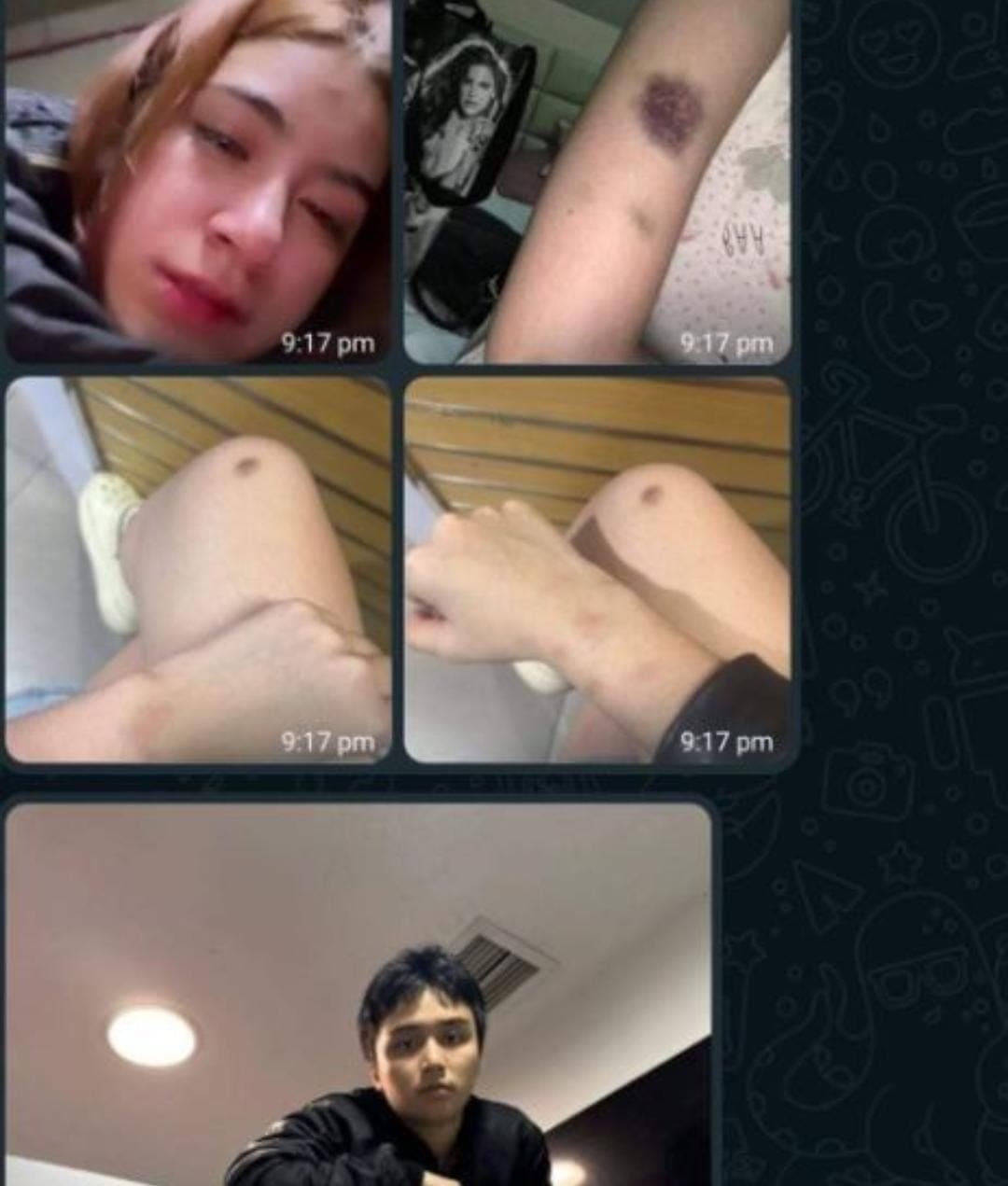 Anak Willy Dozan Aniaya Pacar Hingga Memar Parah, Sebut Enggak Takut Polisi