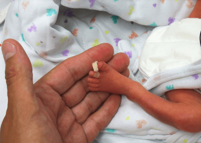 Miris, Bayi Prematur Meninggal Usai Dibikin Konten Newborn Photography Oleh Klinik Tanpa Izin Keluarga