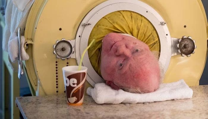 Paul Alexander Pria yang Hidup dengan Paru-paru Besi Selama 7 Dekade Meninggal Dunia