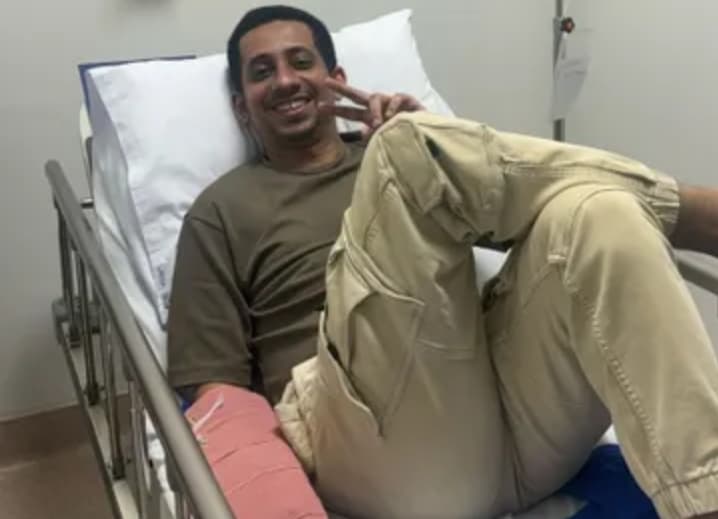 Habib Jafar Kecelakaan, Alami Cedera pada Tangan Kirinya