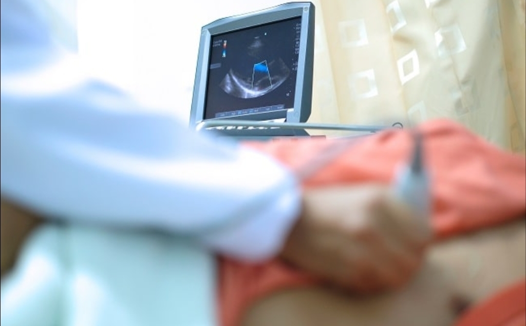 Ekokardiografi Pemeriksaan Jantung Menggunakan Gelombang Ultrasound